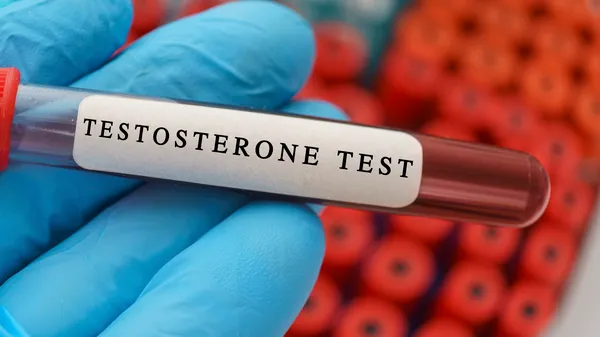 Monitor your testosterone levels