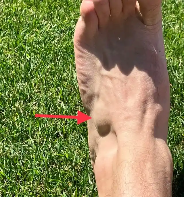 8. Neglecting foot muscles