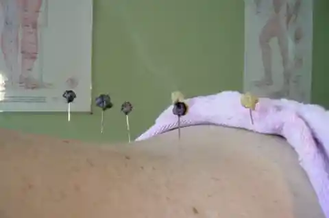 Chinese medicine recommends moxibustion to improve circulation