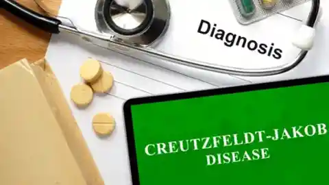 Creutzfeldt-Jakob disease
